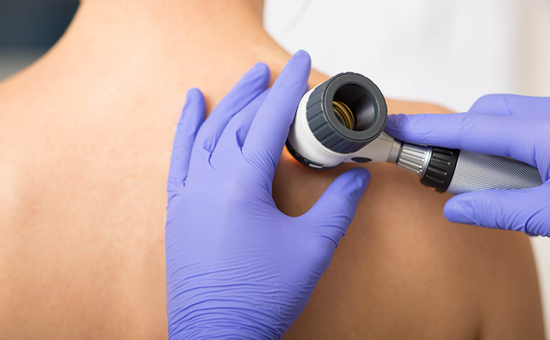 Dermatology-800x495.jpg