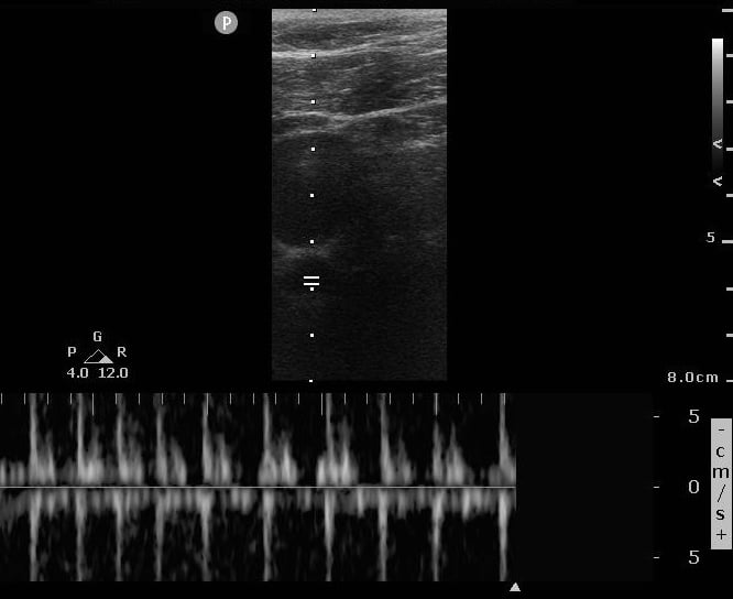 ACLS-Case 1 Img 2.jpg