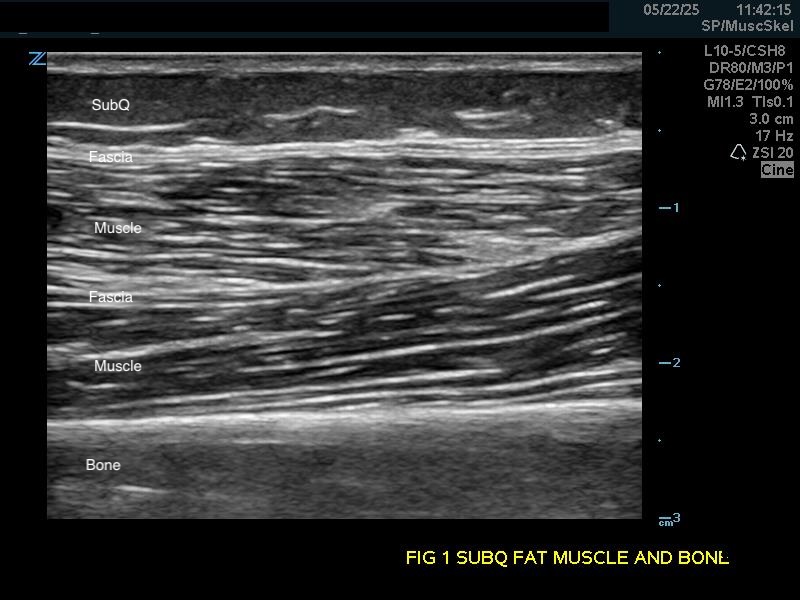 MSK-Figure 1A.jpg