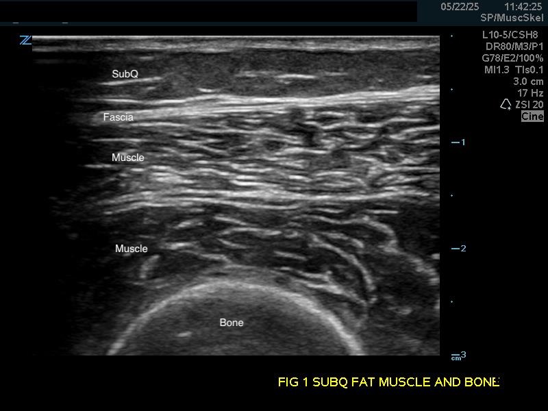 MSK-Figure 1B.jpg