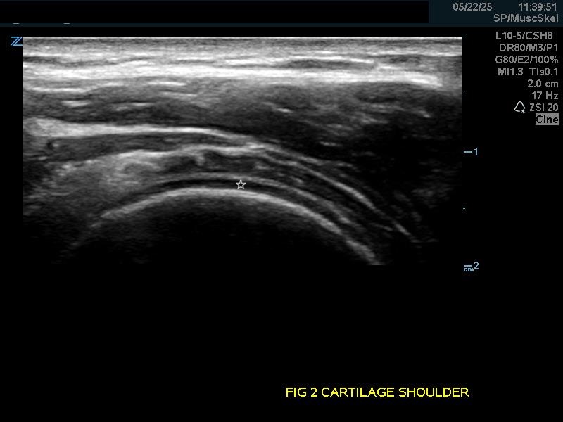 MSK-Figure 2A.jpg
