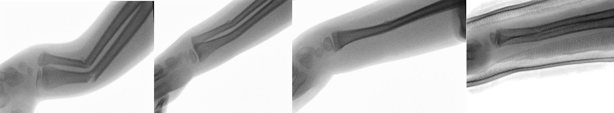 Fluoroscopy-set1.jpg