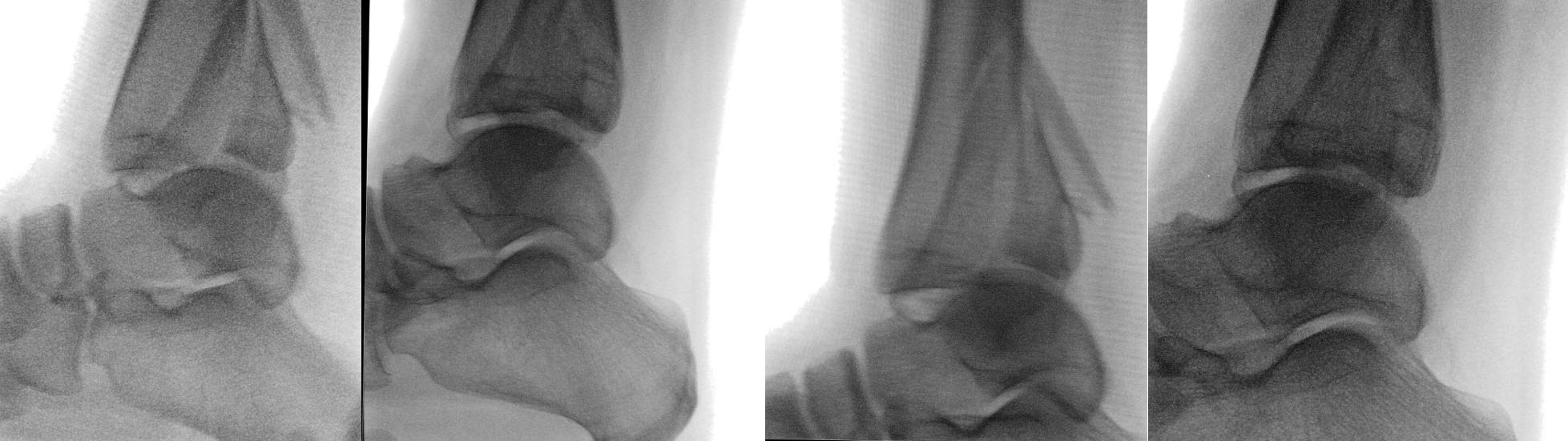 Fluoroscopy-set2.jpg