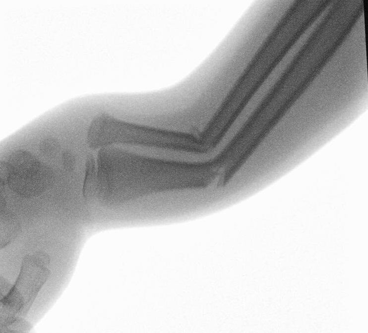 Fluoroscopy-Main.jpg