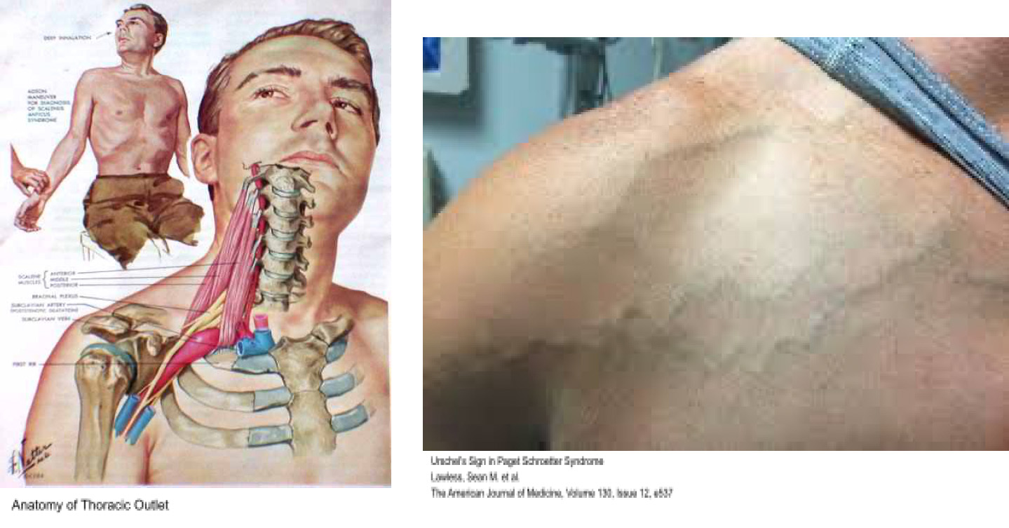NeckPain2.jpg