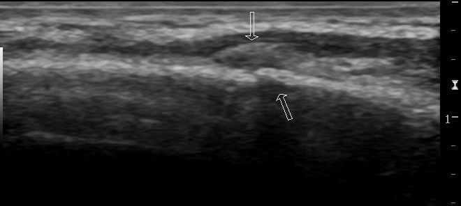 RibFractures-Figure3.jpg