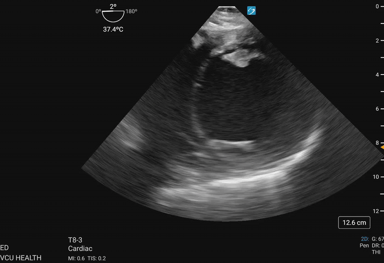 Transgastric_Figure_2_compressed.gif