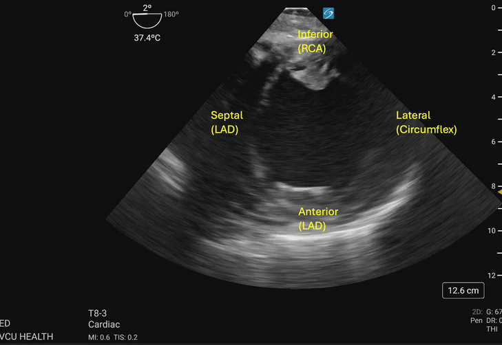 Transgastric_Figure_3a_compressed.gif